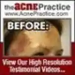 acnepractice.com